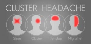 treatment for cluster headaches
