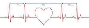 Heart rate variability