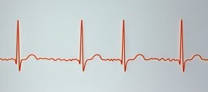 heart rate variability and stress